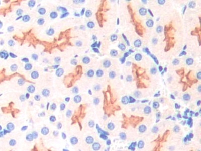 載脂蛋白D(APOD)多克隆抗體