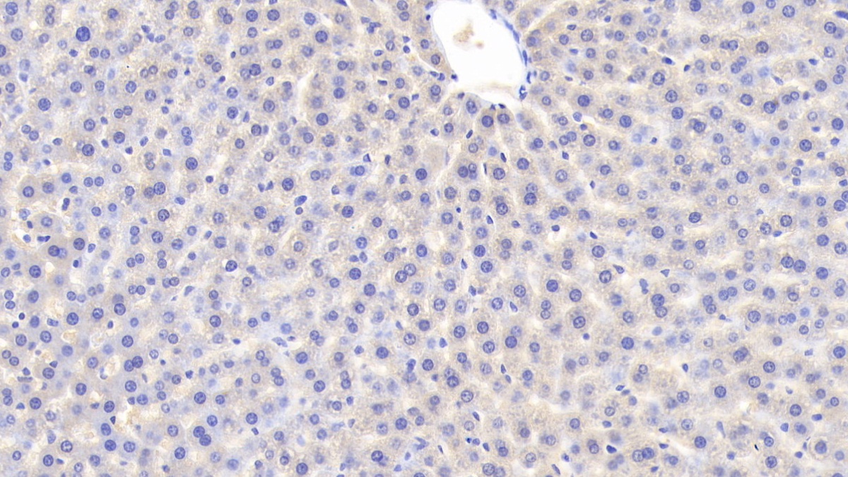 载脂蛋白D(APOD)多克隆抗体