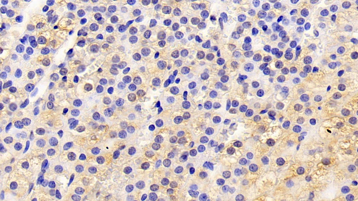 载脂蛋白D(APOD)多克隆抗体