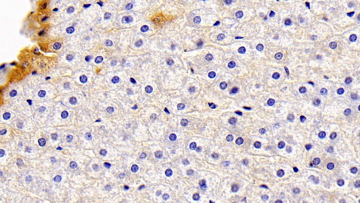 载脂蛋白D(APOD)多克隆抗体