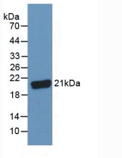 补体成分8γ(C8g)多克隆抗体
