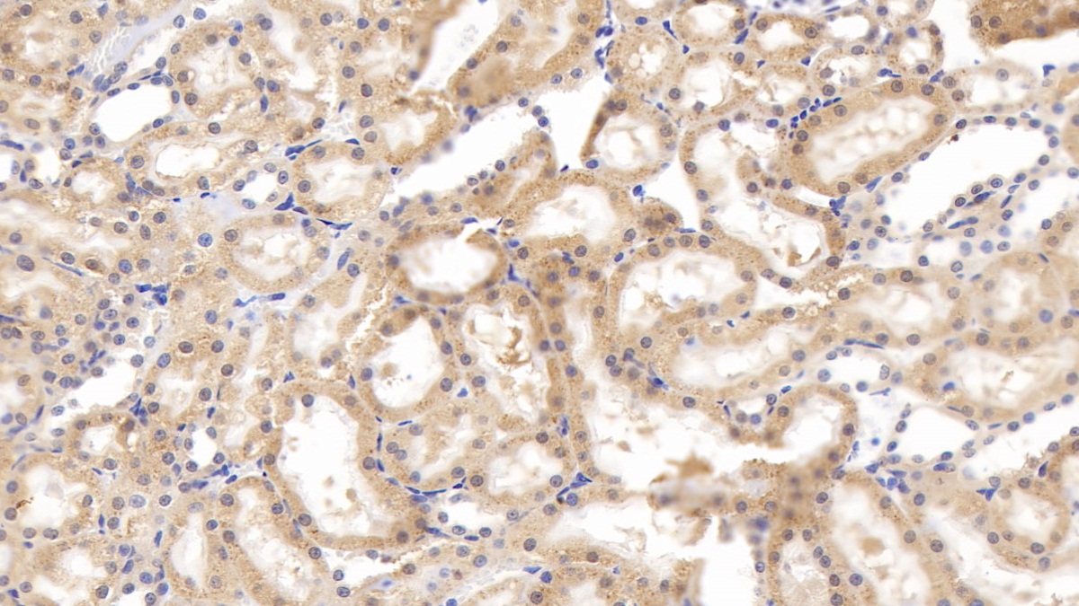 肌腱蛋白C(TNC)多克隆抗体