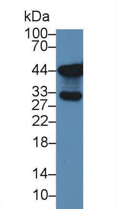 鈉氫交換調(diào)控因子2(SLC9A3R2)多克隆抗體