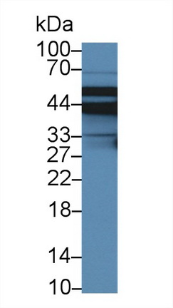 鈉氫交換調(diào)控因子2(SLC9A3R2)多克隆抗體