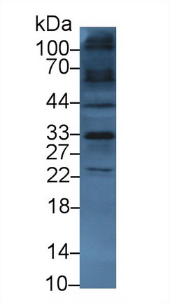 鈉氫交換調(diào)控因子2(SLC9A3R2)多克隆抗體
