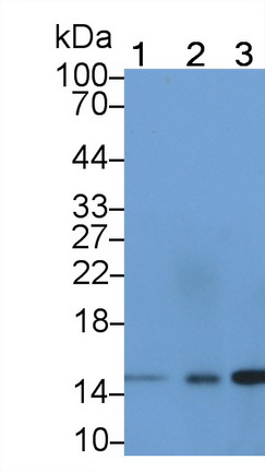 脂肪酸结合蛋白5(FABP5)多克隆抗体