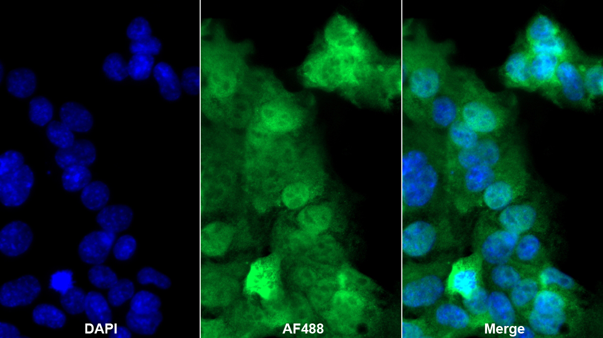 脂肪酸結合蛋白5(FABP5)多克隆抗體