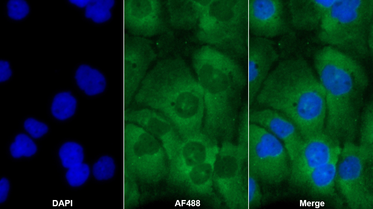 Toll樣受體3(TLR3)多克隆抗體