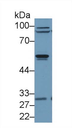 抑制蛋白β2(ARRb2)多克隆抗體