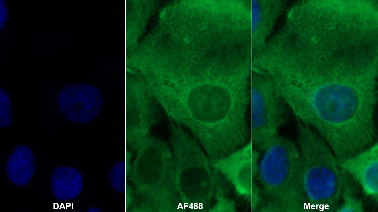 S100鈣結(jié)合蛋白A2(S100A2)多克隆抗體