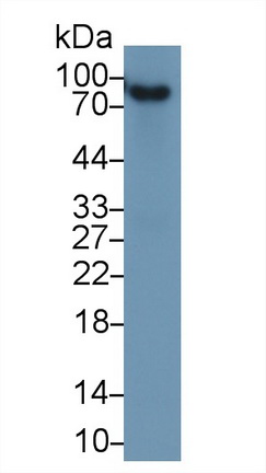 补体因子B(CFB)多克隆抗体