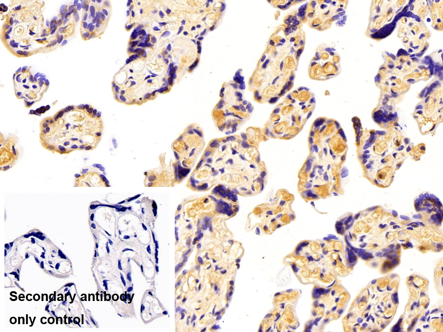 补体因子B(CFB)多克隆抗体