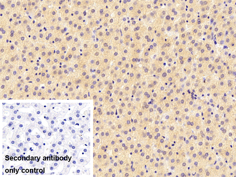 补体因子B(CFB)多克隆抗体