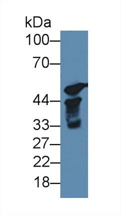 細(xì)胞色素P450 17A1(CYP17A1)多克隆抗體