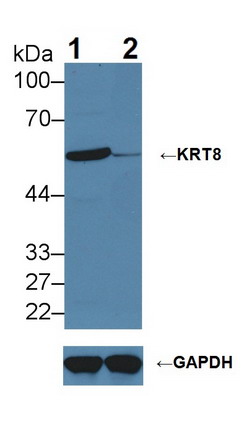 角蛋白8(CK8)多克隆抗体