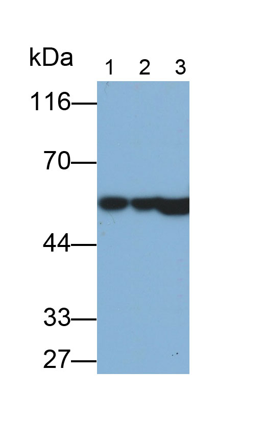 角蛋白8(CK8)多克隆抗體