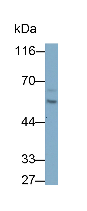 角蛋白8(CK8)多克隆抗体