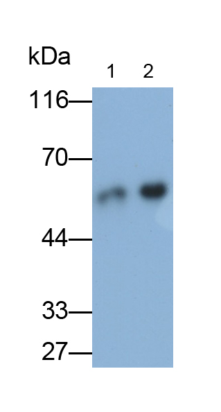 角蛋白8(CK8)多克隆抗體