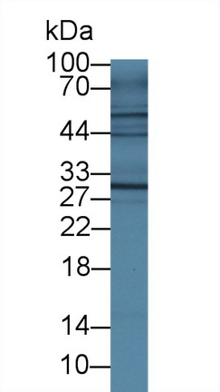 白介素4受体(IL4R)多克隆抗体