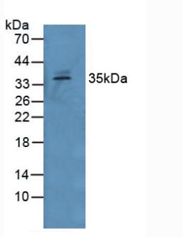 生長分化因子15(GDF15)多克隆抗體