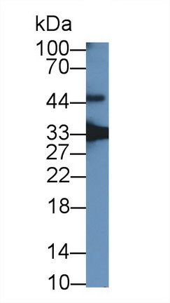 生長(zhǎng)分化因子15(GDF15)多克隆抗體