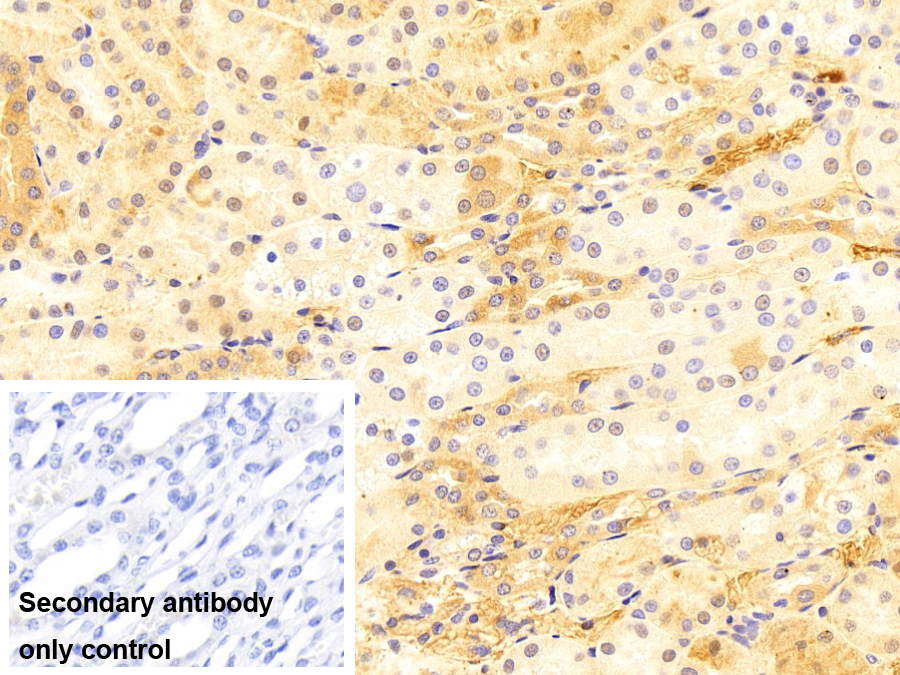 轉(zhuǎn)鐵蛋白(TF)多克隆抗體