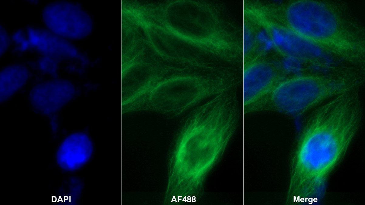 轉(zhuǎn)鐵蛋白(TF)多克隆抗體