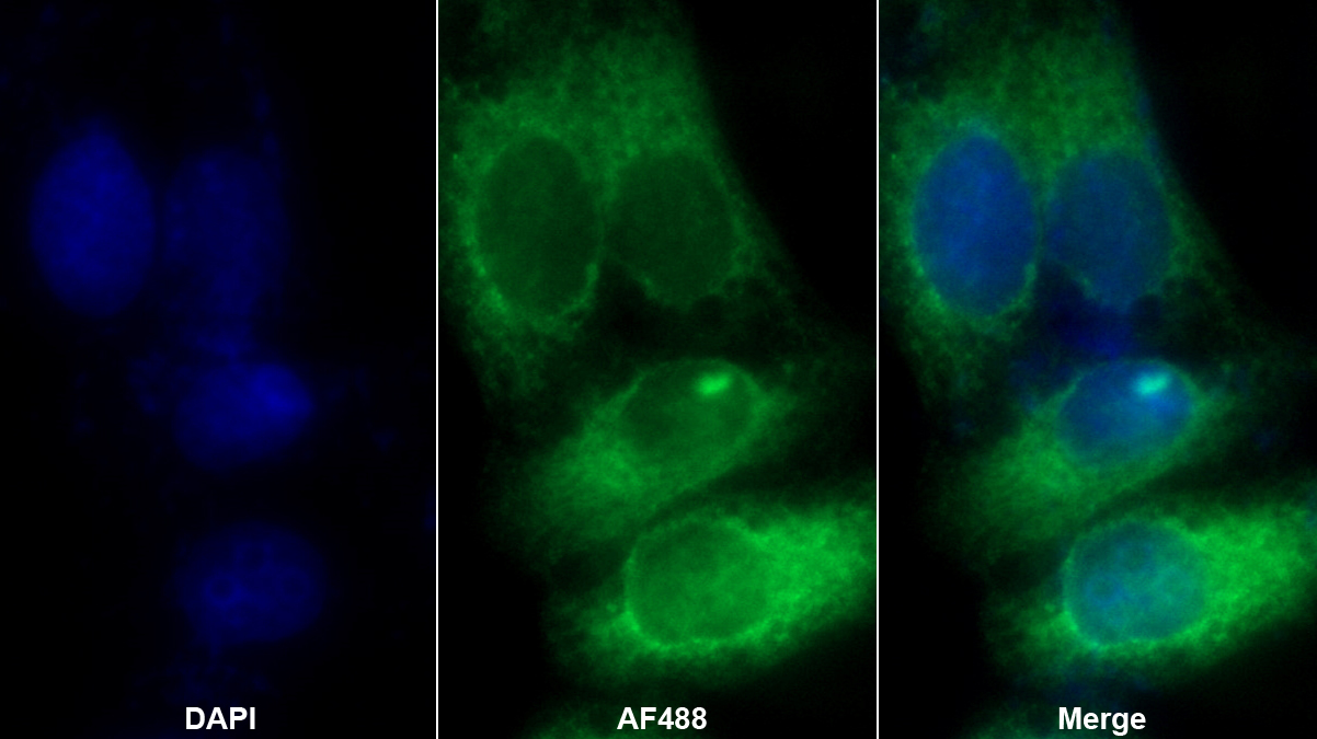 轉(zhuǎn)鐵蛋白(TF)多克隆抗體