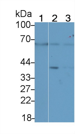 基質(zhì)金屬蛋白酶14(MMP14)多克隆抗體