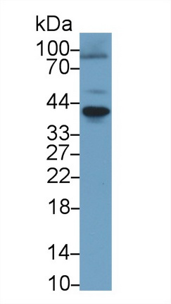 核因子κB受體激活因子(RANk)多克隆抗體