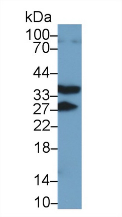 核因子κB受體激活因子(RANk)多克隆抗體