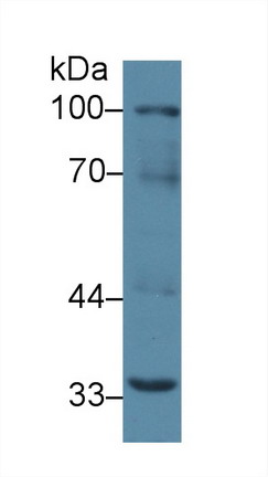 核因子κB受体激活因子(RANk)多克隆抗体