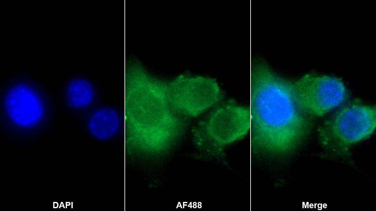 巨噬細(xì)胞炎性蛋白1γ(MIP1g)多克隆抗體