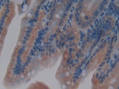 層粘連蛋白γ1(LAMC1)多克隆抗體