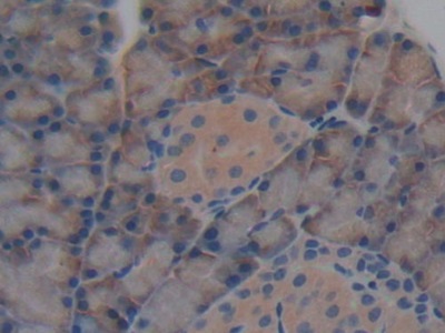 層粘連蛋白γ1(LAMC1)多克隆抗體