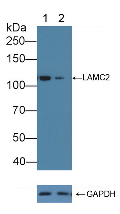 层粘连蛋白γ2(LAMC2)多克隆抗体