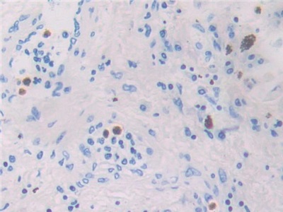 巨噬细胞炎性蛋白4α(MIP4a)多克隆抗体