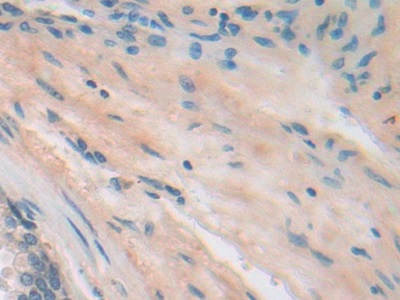整合素β5(ITGb5)多克隆抗體