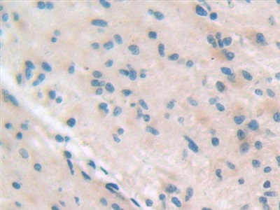 整合素β5(ITGb5)多克隆抗體