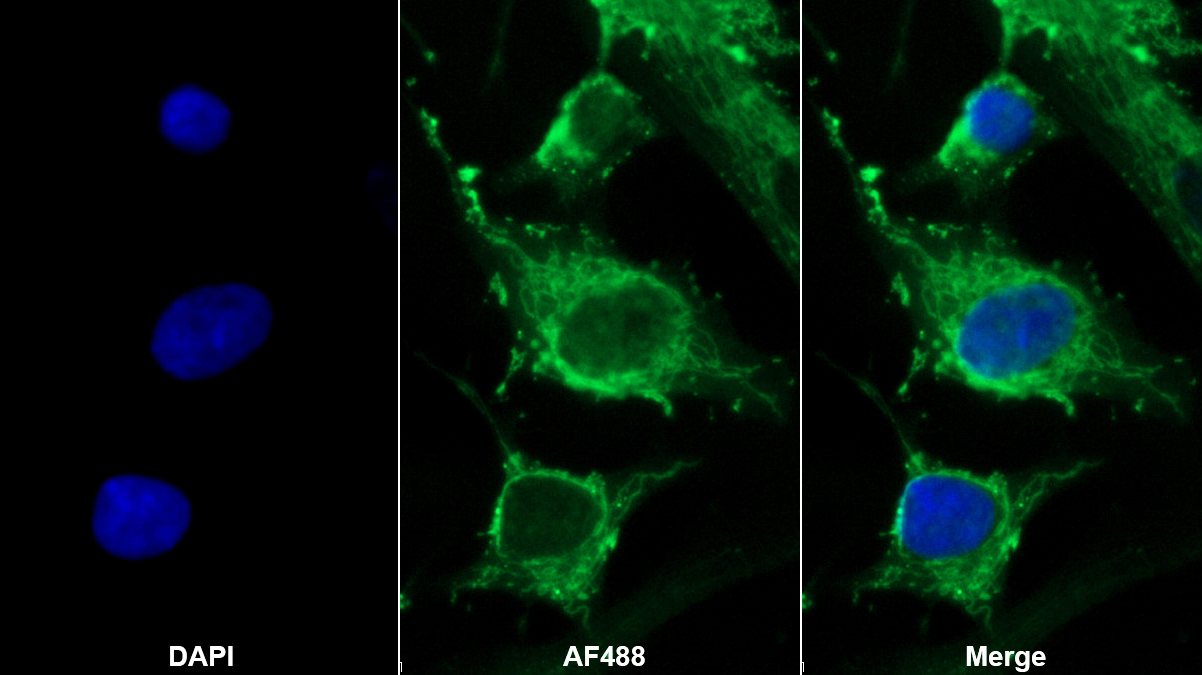 生長分化因子6(GDF6)多克隆抗體