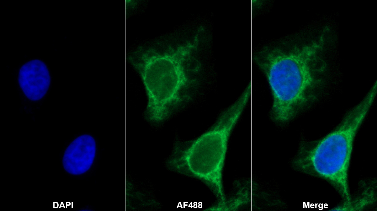 ⅩⅤ型膠原(COL15)多克隆抗體