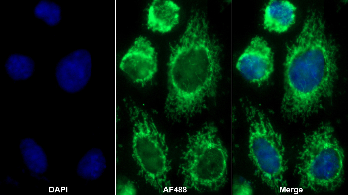 Ⅳ型膠原α3(COL4a3)多克隆抗體