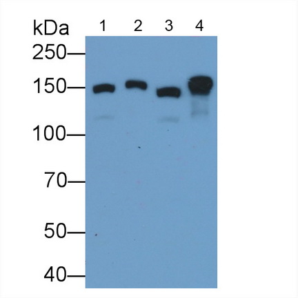 Ⅵ型膠原α1(COL6a1)多克隆抗體
