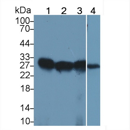 Ⅱ类主要组织相容性复合体DRβ1(HLA-DRB1)多克隆抗体