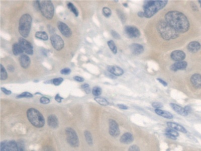 Erb-b2受體酪氨酸激酶4(ErbB4)多克隆抗體