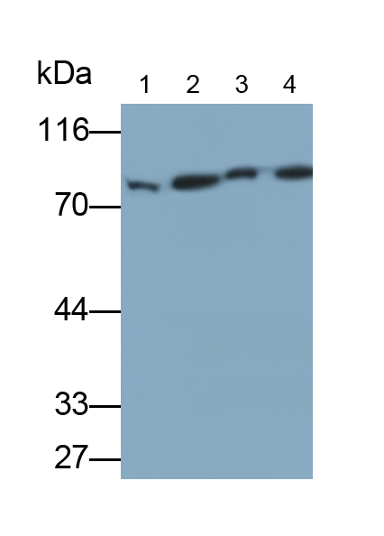 連接橋粒斑珠蛋白(JUP)多克隆抗體