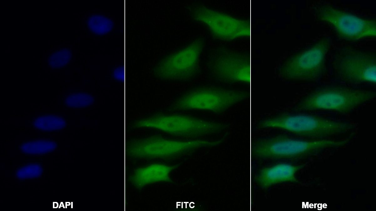 组蛋白脱乙酰基酶1(HDAC1)多克隆抗体