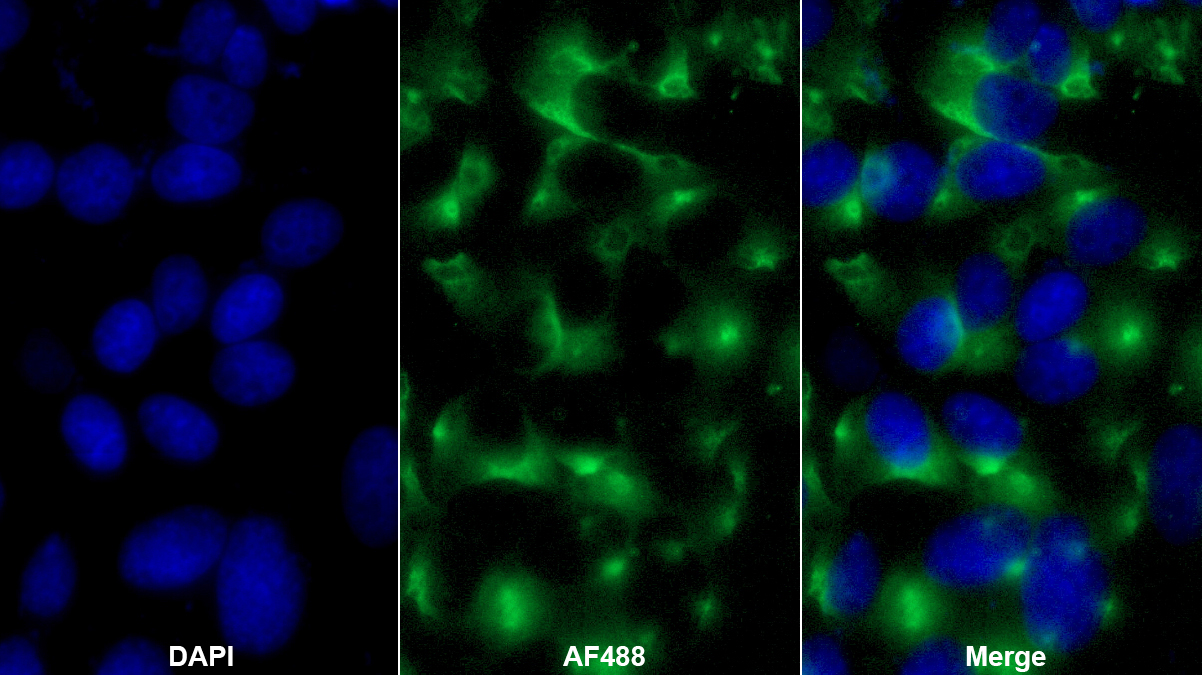 G蛋白αZ(GNaZ)多克隆抗體