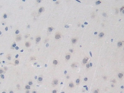 含溴區(qū)蛋白8(BRD8)多克隆抗體
