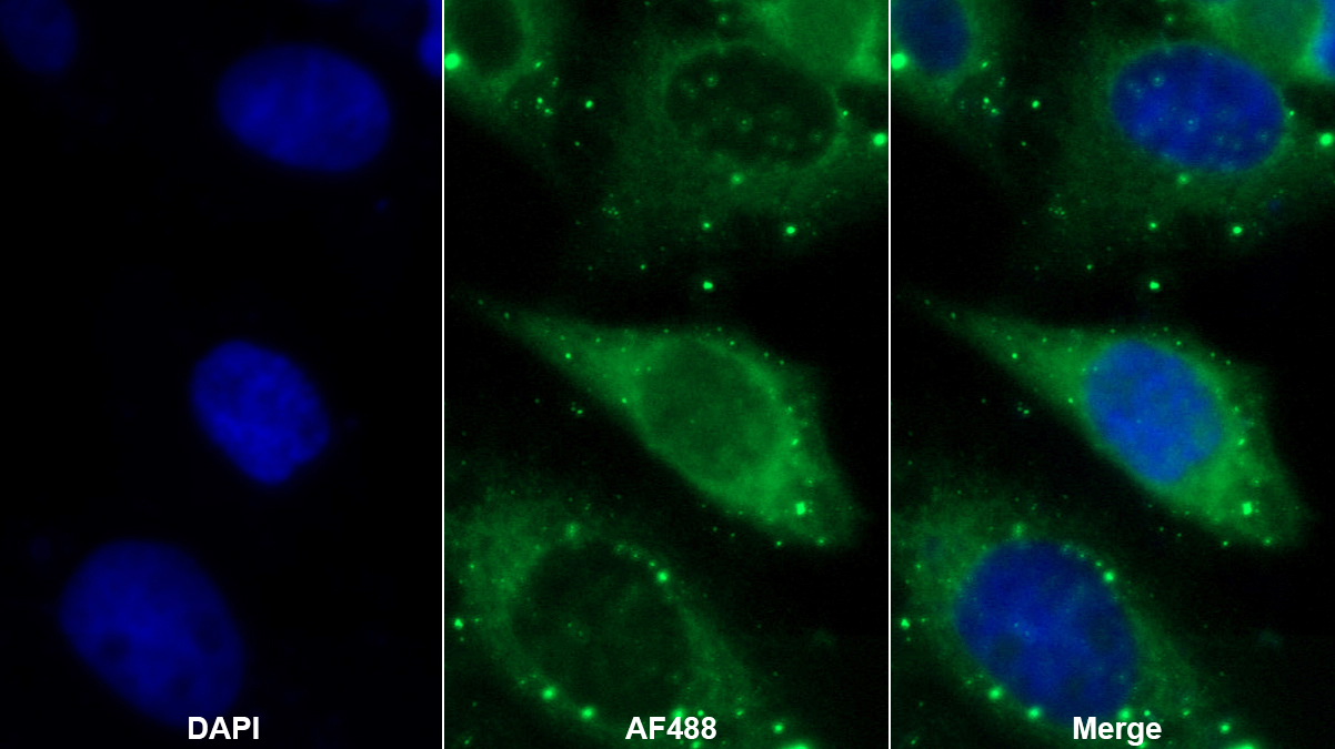 氨基乙二酸半醛磷酸泛酰巰基乙胺基轉(zhuǎn)移酶(AASDHPPT)多克隆抗體